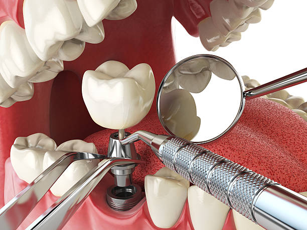 Best Emergency Dental Surgery in Greenville, SC